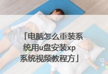 联想台式机XP升级为Windows7系统教程（简易操作教您快速将联想台式机XP升级为Windows7系统）